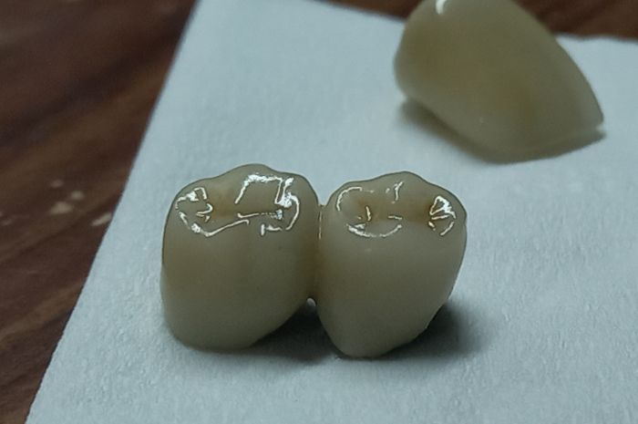 Mahasiswa D3 Teknik Gigi Mempelajari Alat dan Bahan ‘Baru’ Saat PKL di Sinar Mulya Dental Laboratorium