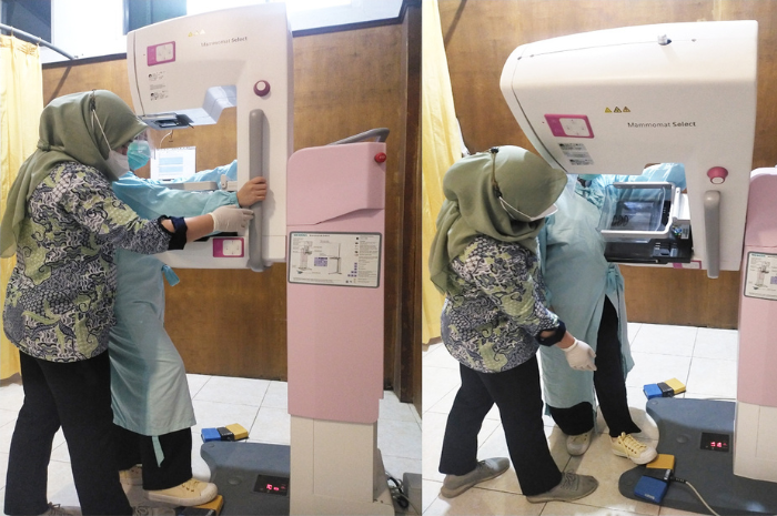Potret Teknik Kompresi Mandiri pada pasien mammografi/dokumen istimewa