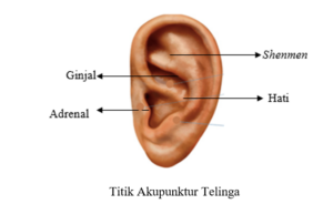 ilustrasi titik akupunktur pada telinga/dokumen penulis