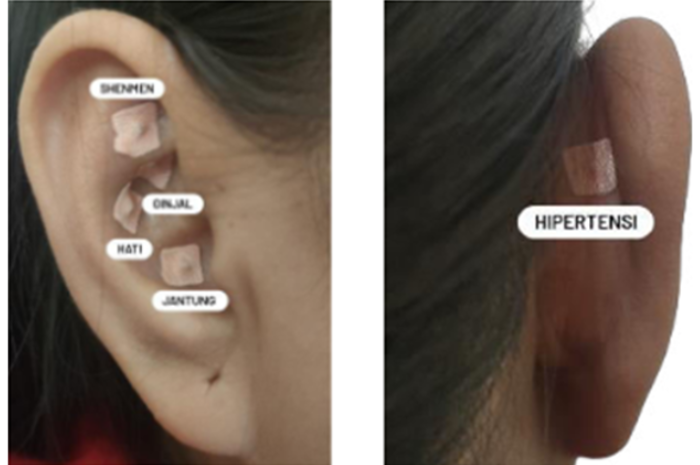 Telinga dan titik auriculopuncture/dokumen istimewa