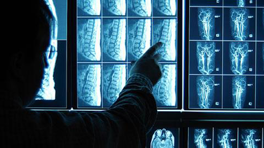 Mengetahui Hernia Nucleus Pulposus (Saraf Kejepit) Dengan Alat Canggih MRI