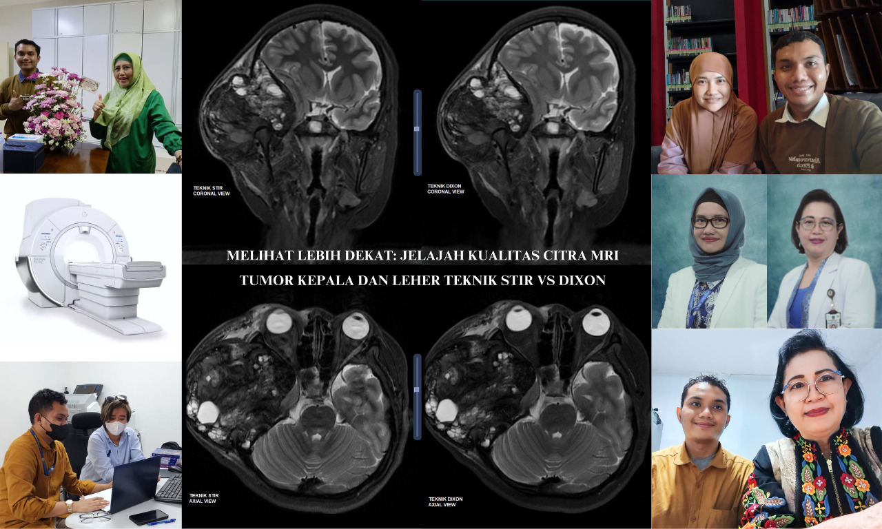Melihat Lebih Dekat: Jelajah Kualitas Citra MRI Tumor Kepala dan Leher Teknik STIR vs Dixon