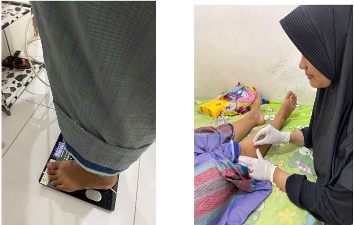 Terapi Elektroakupunktur Solusi Alternatif Penurunan Berat Badan Wanita Obesitas