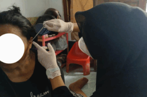 Pengaruh Terapi Auricular Pressure Titik Shenmen, Ginjal, Hati, dan Occiput Terhadap Nyeri Kepala Hipertensi_Dokumen Istimewa