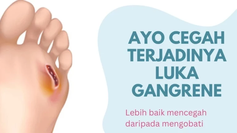 Pencegahan Luka Gangrene Pada Pasien Diabetes Melitus_Dokumen Istimewa