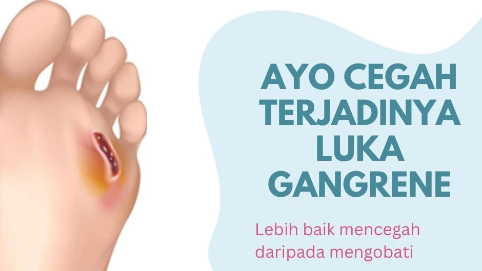 Pencegahan Luka Gangrene Pada Pasien Diabetes Melitus_Dokumen Istimewa
