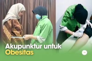 Modifikasi Jin’s 3 Needle Menjadi Akupunktur Efektif Turunkan Ukuran Tubuh Penderita Obesitas_Dokumen Istimewa