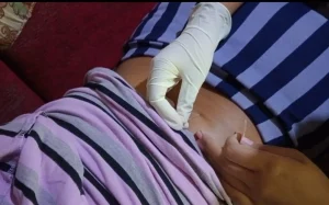 Efektivitas Terapi Akupuntur Terhadap Low Back Pain_Dokumen Istimewa