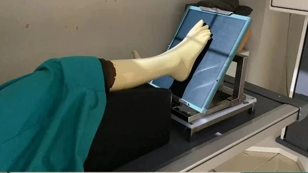Inovasi Radiologi: Desain Rancang Bangun Alat Fiksasi Radiografi Os Pedis untuk Pasien Post Operasi_Dokumen Istimewa