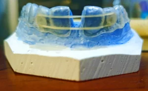 Pembuatan Clear Retainer Penambahan Kait pada Diastema Sentral Rahang Atas_Doumen Istimewa