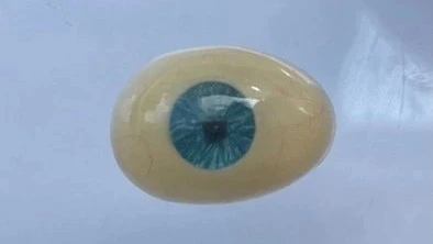 Peosedur Pembuatan Protesa Mata Ocular Berwarna Biru_Dokumen Istimewa
