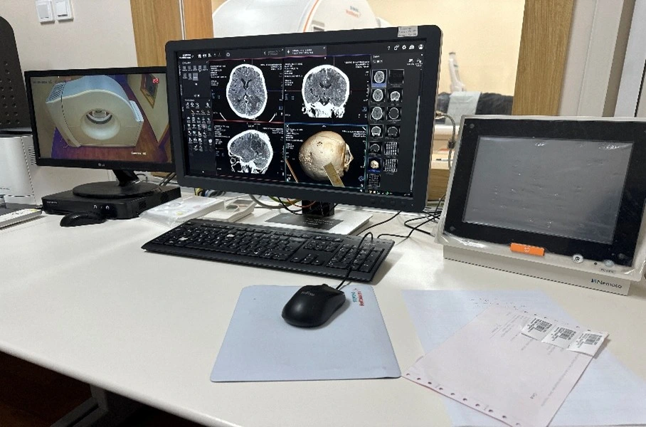 Optimalisasi Dosis Radiasi pada CT-Scan Kepala_Dokumen Istimewa