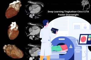 Deep Learning Tingkatkan Citra CCTA Pasien Overweight_Dokumen Istimewa