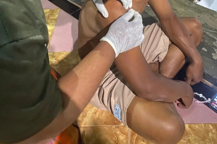 Pemberian Terapi Akupunktur Jianyu, Binao, Jianzhosu, dan Jianjing Pada Penderita Nyeri Bahu Pekerja Pabrik_Dokumen Istimewa
