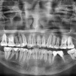Pentingnya Komunikasi Efektif dalam Pemeriksaan Radiografi Panoramik_Dokumen Istimewa