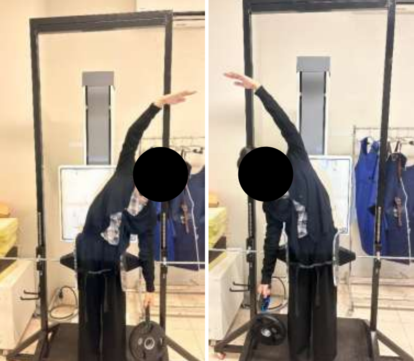 Inovasi Alat Fiksasi Tingkatkan Kenyamanan Fisik dan Ergonomi Pemeriksaan Skoliosis