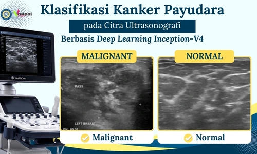 Klasifikasi Kanker Payudara pada Citra Ultrasonografi Berbasis Deep Learning Inception-V4